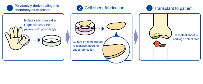 Allogeneic Chondrocyte Sheet