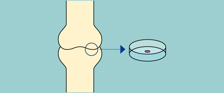 Autologous chondrocyte sheets