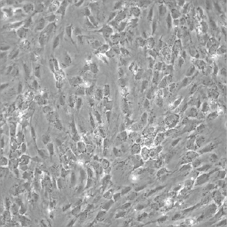 Normal culture 1x105 cells seeded and incubated for 72 hrs. RepCell® 6cm dish used